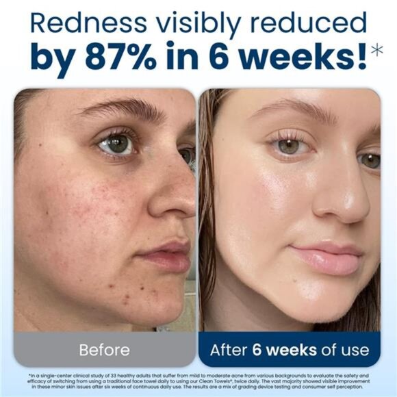 Clean Skin Club Clean Towels XL, 100% USDA Biobased Face Towel Disposable - Picture 3 of 7